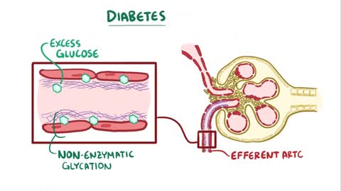 The Chronic Kidney Disease Solution