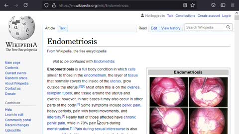 Treating Endometriosis with Chinese Herbs