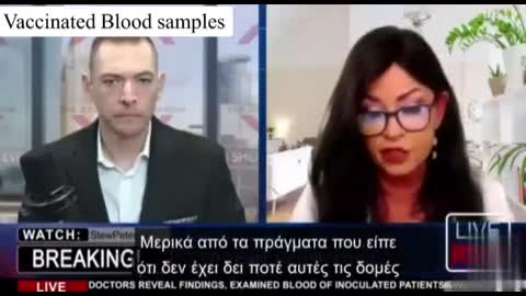 Examined Blood of Inoculated Patients - ΔΕΙΤΕ ΤΙ ΒΡΙΣΚΟΥΝ ΣΤΟ ΑΙΜΑ ΤΩΝ ΕΜΒΟΛΙΑΣΜΕΝΩΝ