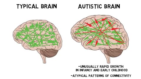 2-Minute Neuroscience: Autism