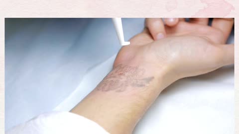 Bored Of Your Old & Dull Tattoo? Get Rid Of It Now!