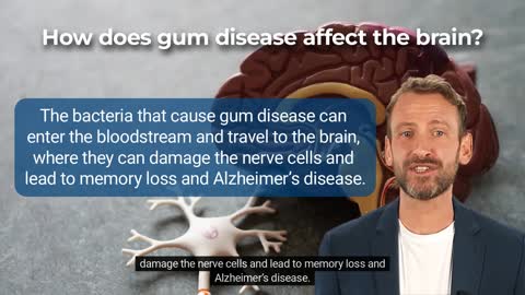 Can Gum Disease Cause Memory Loss, Alzheimer's or Dementia?