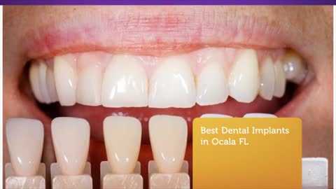 Ocala Dental Harmony - Best Dental Implants in Ocala FL