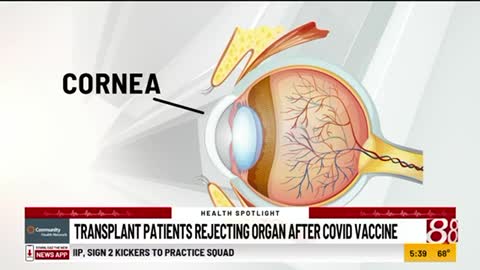 COVID-19 Vaccines | Transplant Patients Rejecting Organs After Receiving COVID-19 Vaccine