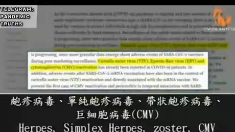 醫學專家Urso博士：新冠實驗針劑中的脂質納米粒子會持續60天製造毒性刺突蛋白；亂竄到各臟器和進入大腦；會阻擋或抑制基因守護者，使癌症病患和死亡暴增！此訊息製藥業和政府未告知人民