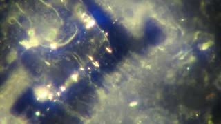 DARK FIELD MICROSCOPY BY DR DAVID NIXON (2 minutes)