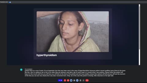 Hyperthyroidism Muzzamil