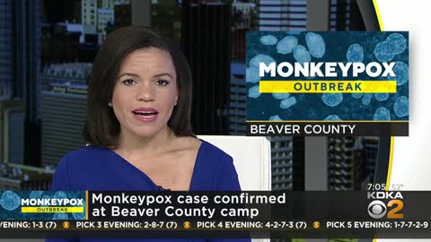 Case of monkeypox confirmed at Beaver County Camp