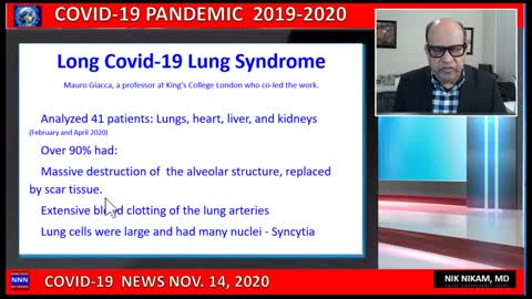 COVID 19 LONG COVID-19 LUNG SYNDROME NIK NIKAM MD