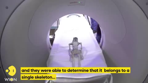 Mexican UFO expert conduct X-ray on NON-human being watch out in the video!!