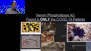 Venom Researcher Dr. Bryan Ardis with more on the snake and snail venom peptides found in Covid patients