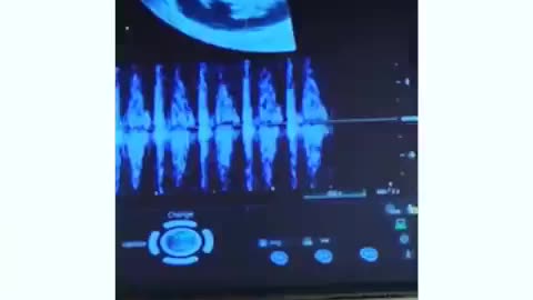 WOW! Unborn Baby's Heartbeat at 7 Weeks