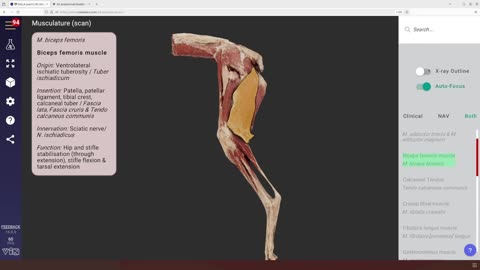 3D Anatomy Feature: Improved highlight effect