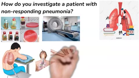 What is non- responding Pneumonia ( NRP)