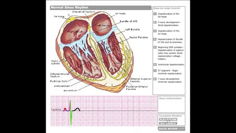 Dr Stanley's ECGcourse.com | Normal Sinus Rhythm