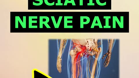 Top 3 remedies for sciatic nerve pain