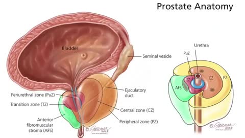 🔥🔥Vitalflow Prostate Reviews 2022& Discount - Does it Work?💪🔥🔥