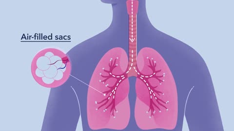 How COVID-19 Affects