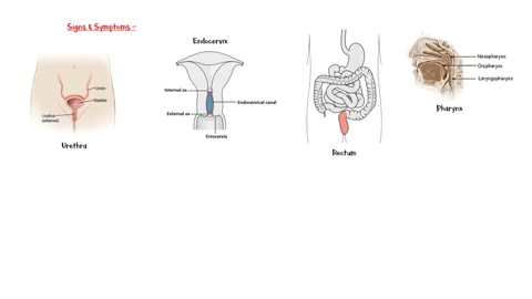 Chlamydia Infection - Causes, Risk Factors, Signs & Symptoms, Diagnosis & Treatment