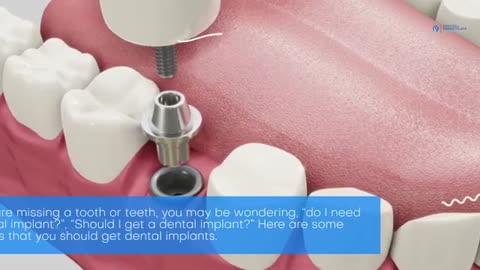 Considering a Dental Implant? Here are Some Reasons Why You Should