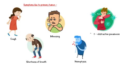 Lung Cancer _- Signs & Symptoms _Patient Education