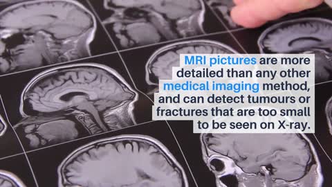 MRI Singapore