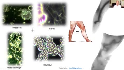 COMPUTERIZED THERMOGRAPHIC IMAGING & LIVE BLOOD ANALYSIS POST C19 INJECTION