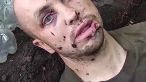 Russian Soldiers Save Ukrainian Service-member After His Own Leave Him For Dead