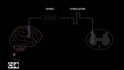 Elon Musk wants to implant radial chips in humans: would you accept it?