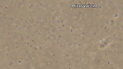충격적! 한국의사가 현미경으로 백신을 보는데, 수많은 부유물 확인!