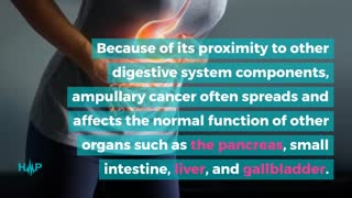 What Are The Symptoms Of Ampullary Cancer?