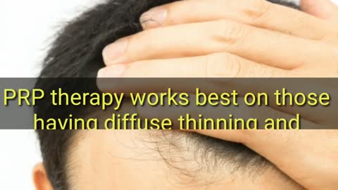 PRP Therapy in Delhi, PRP Treatment for hair loss in Delhi by Best Dermatologist in Delhi