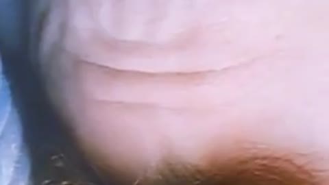Joaquin Phoenix's Forehead