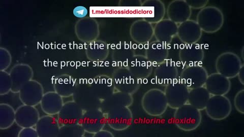 Sangue prima e dopo diossido di cloro