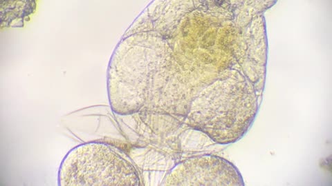 Microscopic View of “L” Type Rotifer