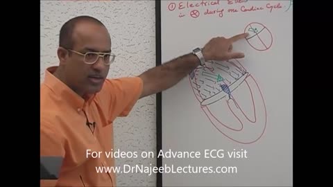ECG Interpretation EKG