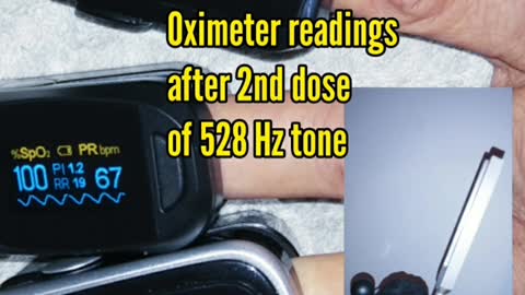 Oximeter readings after 2nd dose of 528 Hz tone