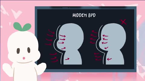 Hidden Signs of Borderline Personality Disorder
