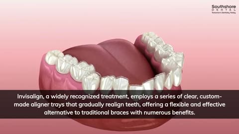 The Top Benefits of Invisalign Braces