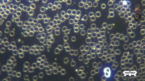 Selbstreplizierende Nanobots in Geimpften und Ungeimpften gefunden (The Reese Report-Deutsch)