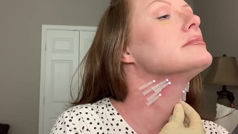 TIGHTENING MY TURKEY NECK || DIY AT HOME NECK LIFT with PDO threads from GlamCosm - code NISA10 saves 20%