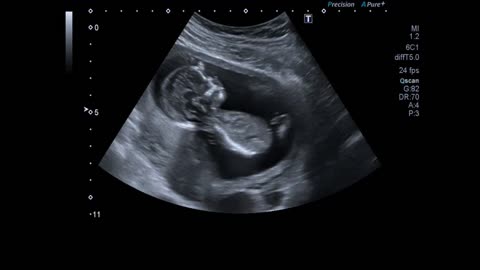 Fhe Fetus, when the wonderful life begin