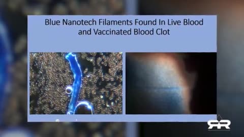 The Greg Reese Report: Nanotechnology Found in Both Vaxxed And Un-Vaxxed