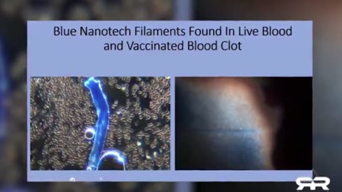 Nano Technology Found In Both VAXXED and UN-VAXXED