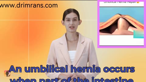 Umbilical hernia surgery