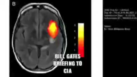 Bill Gates Secret Presentation to CIA