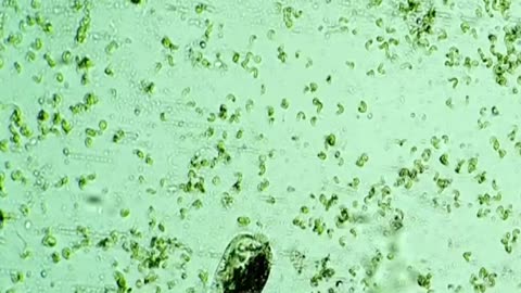 Brain eating amoeba (Virus)
