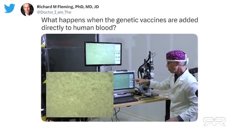 Thermographic Imaging Shows Massive Blood Clots in the Asymptomatic Vaxxed