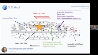 168. Fascia Tissue Distress - The Root Cause of Pain