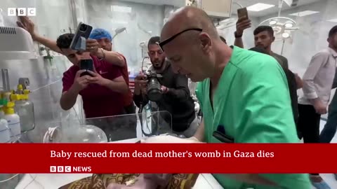 Baby saved from dead mother's womb in Gaza dies BBC News